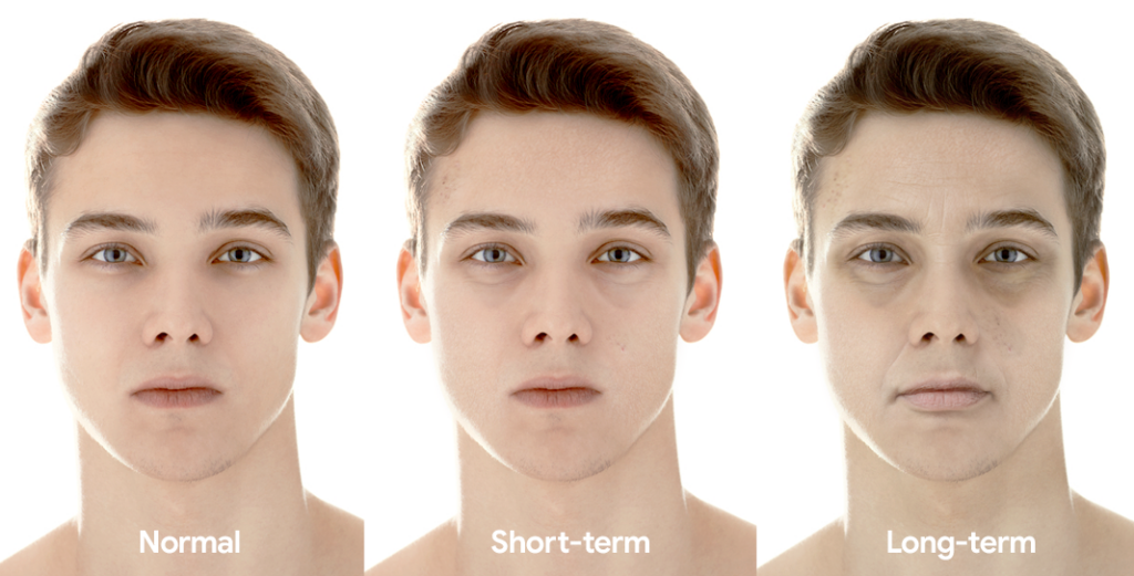 Man showing before, short-term and long-term effects of sleep deprivation on the face